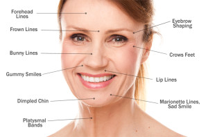 botox picture with arrows