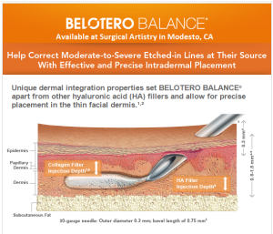 Superficial injection of Belotero works!