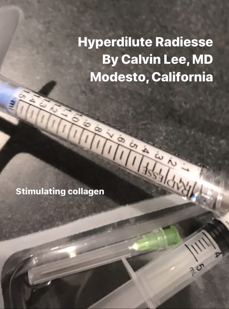 Hyperdilute Radiesse Modesto Botox, Dr. Calvin Lee